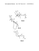 SURGICAL RETRIEVAL APPARATUS diagram and image