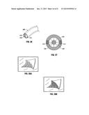 SURGICAL RETRIEVAL APPARATUS diagram and image