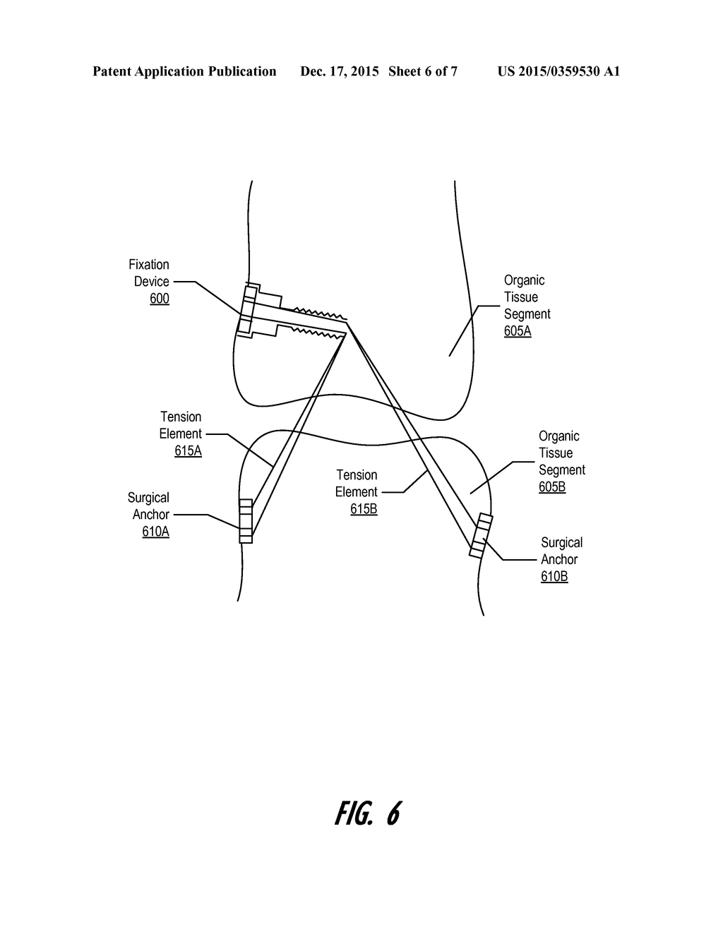 VECTOR FIXATION DEVICE - diagram, schematic, and image 07