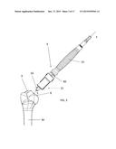 INSTRUMENT FOR THE REMOVAL OF A BONE INSERT AND CORRESPONDING METHOD diagram and image