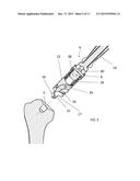 INSTRUMENT FOR THE REMOVAL OF A BONE INSERT AND CORRESPONDING METHOD diagram and image