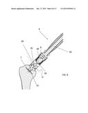 INSTRUMENT FOR THE REMOVAL OF A BONE INSERT AND CORRESPONDING METHOD diagram and image