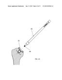 INSTRUMENT FOR THE REMOVAL OF A BONE INSERT AND CORRESPONDING METHOD diagram and image