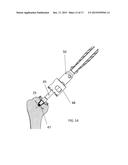 INSTRUMENT FOR THE REMOVAL OF A BONE INSERT AND CORRESPONDING METHOD diagram and image