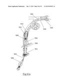 DEVICES AND METHODS FOR REMOVAL OF ACUTE BLOCKAGES FROM BLOOD VESSELS diagram and image