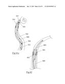 DEVICES AND METHODS FOR REMOVAL OF ACUTE BLOCKAGES FROM BLOOD VESSELS diagram and image