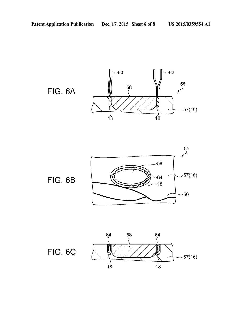 CELLULAR TISSUE DISSECTION METHOD - diagram, schematic, and image 07