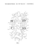 BONE FASTENER AND METHODS OF USE diagram and image