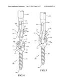 SINGLE ACTION LOCKING PEDICLE SCREWDRIVER diagram and image