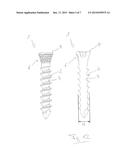 SURGICAL BONE SCREW AND IMPLANT SYSTEM diagram and image