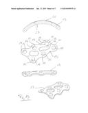 SURGICAL BONE SCREW AND IMPLANT SYSTEM diagram and image