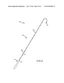 HIGH-VOLTAGE PULSE ABLATION SYSTEMS AND METHODS diagram and image