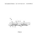 HIGH-VOLTAGE PULSE ABLATION SYSTEMS AND METHODS diagram and image