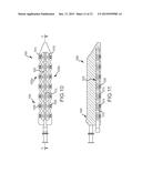 HIGH-VOLTAGE PULSE ABLATION SYSTEMS AND METHODS diagram and image