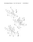 DEVICE AND METHOD FOR ALLEVIATION OF PAIN diagram and image