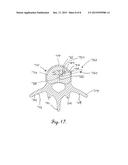 DEVICE AND METHOD FOR ALLEVIATION OF PAIN diagram and image