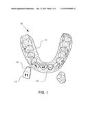 METHOD FOR PRODUCING AN ORTHODONTIC SETUP diagram and image