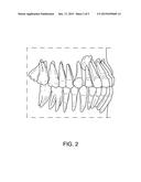 METHOD FOR PRODUCING AN ORTHODONTIC SETUP diagram and image