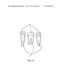 METHOD FOR PRODUCING AN ORTHODONTIC SETUP diagram and image