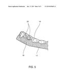 METHOD FOR PRODUCING AN ORTHODONTIC SETUP diagram and image