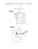 POCKET ORTHODONTIC BONDING PAD diagram and image