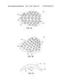 APPARATUS AND METHOD FOR BONE AUGMENTATION diagram and image