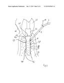 Ceramic Body, in Particular for Use As a Dental Implant diagram and image