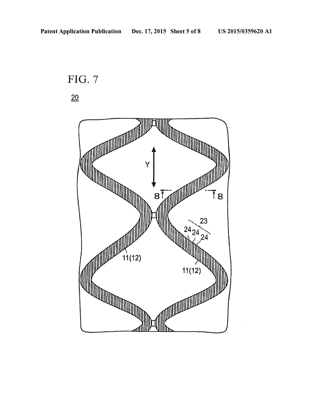 STENT - diagram, schematic, and image 06