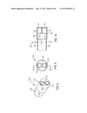 ACETABULAR CUP REMOVER WITH INDEXING ASSEMBLY FOR ROTATING THE REMOVAL     BLADE AROUND THE CUP diagram and image