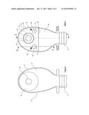 OSTOMY APPLIANCE diagram and image