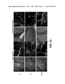 ENZYME RESPONSIVE NANOCAPSULES FOR PROTEIN DELIVERY diagram and image