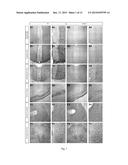 COMPOSITIONS AND METHODS FOR THE TREATMENT OF PERVASIVE DEVELOPMENT     DISORDERS diagram and image