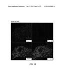 TRANSCRIPTION FACTOR-BASED GENERATION OF PACEMAKER CELLS AND METHODS OF     USING SAME diagram and image