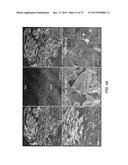 TRANSCRIPTION FACTOR-BASED GENERATION OF PACEMAKER CELLS AND METHODS OF     USING SAME diagram and image