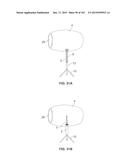 PORTABLE UV DEVICES, SYSTEMS AND METHODS OF USE AND MANUFACTURING diagram and image