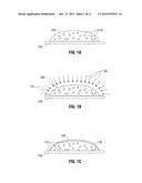 HYDROGEL IMPLANTS WITH VARYING DEGREES OF CROSSLINKING diagram and image