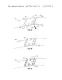 HYDROGEL IMPLANTS WITH VARYING DEGREES OF CROSSLINKING diagram and image