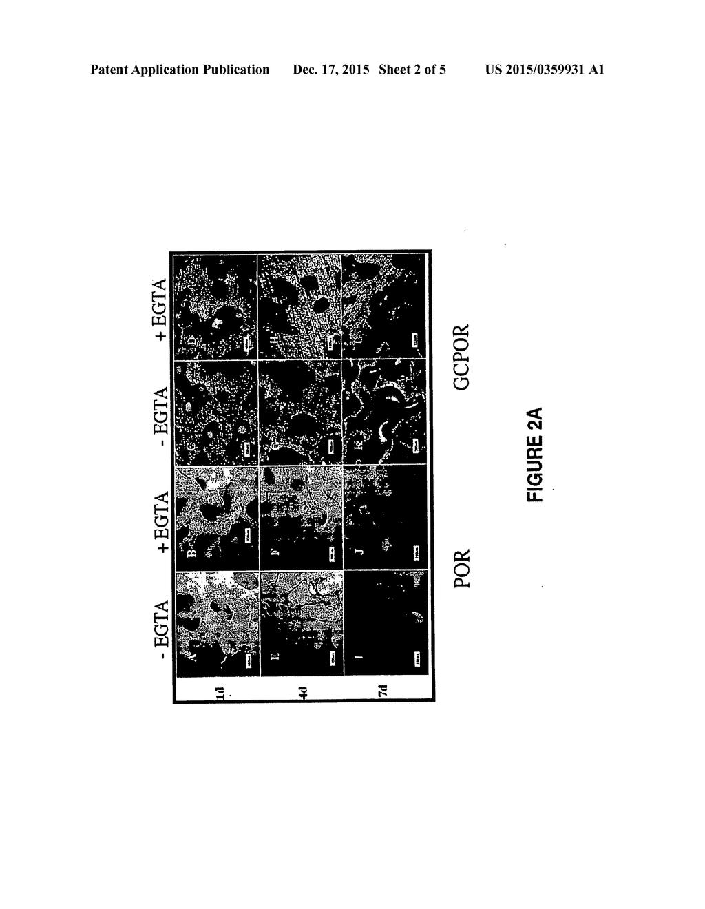 Calcium-Mediated Effects of Coral and Methods of Use Thereof - diagram, schematic, and image 03