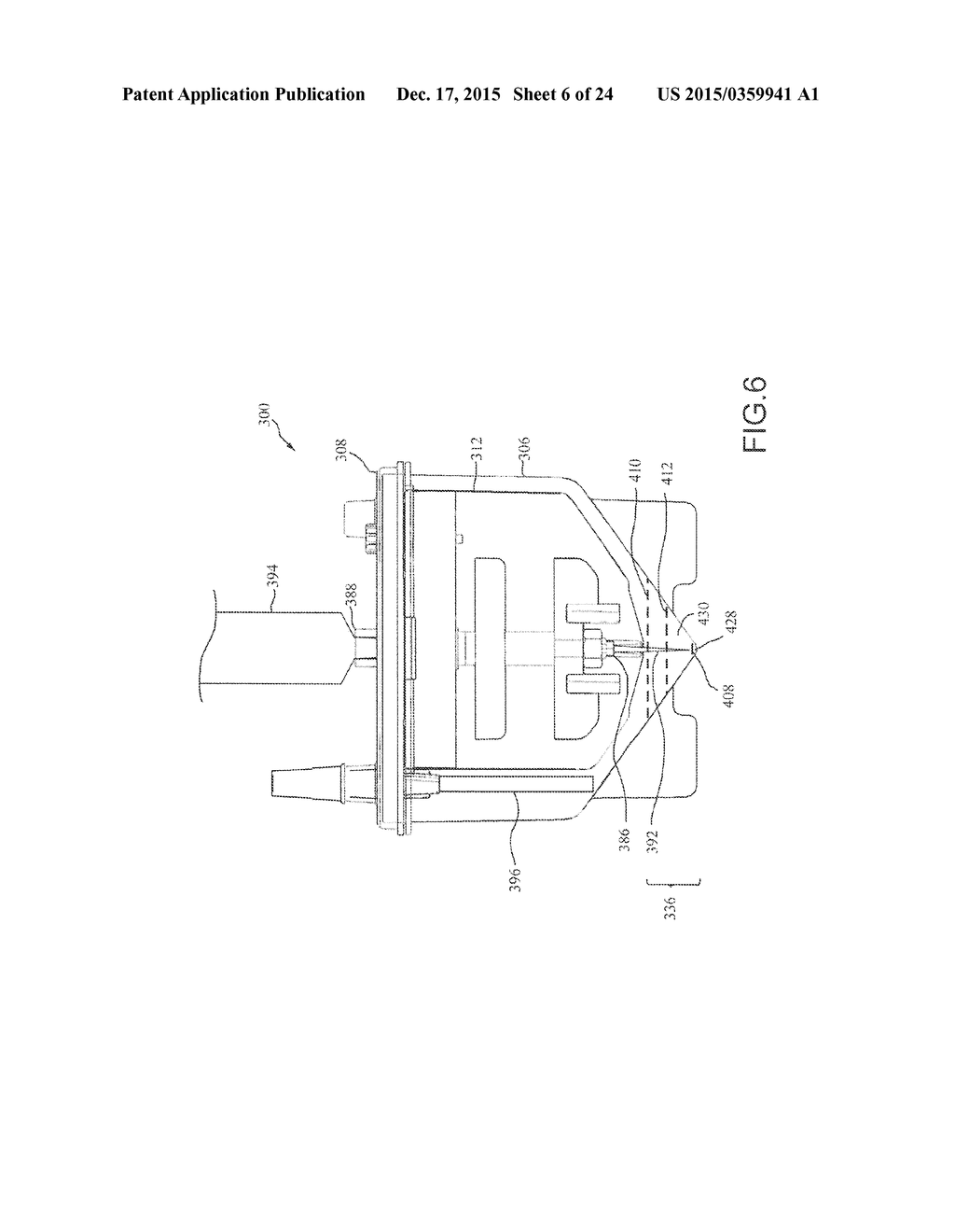 METHOD FOR PROCESSING CANCELLOUS BONE MATERIAL AND RELATED PRODUCTS,     METHODS AND USES - diagram, schematic, and image 07