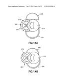 User-Actuated Storage Assembly For Injection Device diagram and image