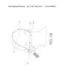 Nasally Mounted Respiratory Mask diagram and image