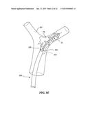 RETRACTION AND ASPIRATION DEVICE FOR TREATING EMBOLISM AND ASSOCIATED     SYSTEMS AND METHODS diagram and image