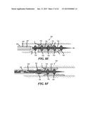 RETRACTION AND ASPIRATION DEVICE FOR TREATING EMBOLISM AND ASSOCIATED     SYSTEMS AND METHODS diagram and image