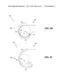 RETRACTION AND ASPIRATION DEVICE FOR TREATING EMBOLISM AND ASSOCIATED     SYSTEMS AND METHODS diagram and image