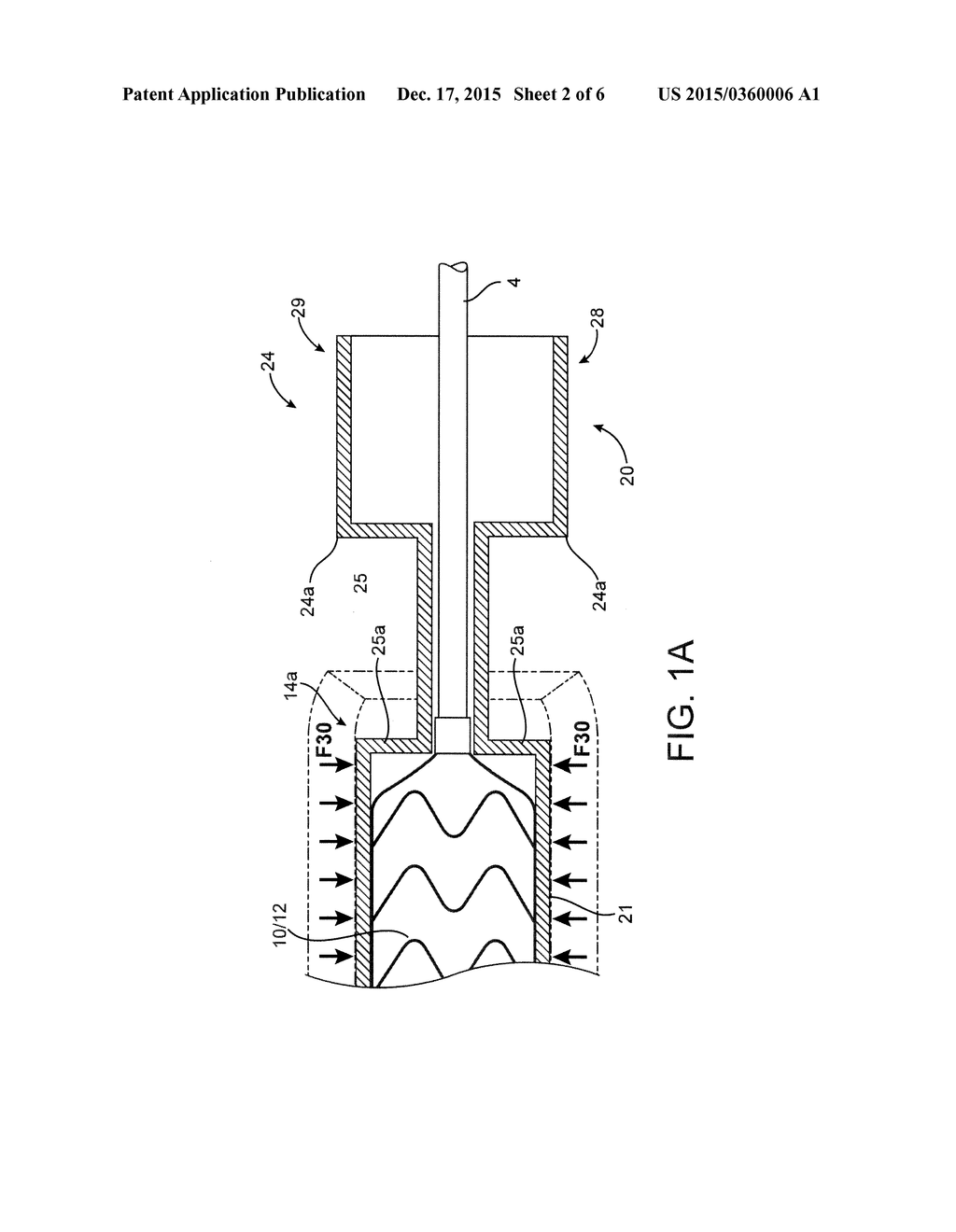 POLYMER SCAFFOLD SHEATHS - diagram, schematic, and image 03