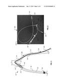 MULTIFUNCTIONAL OCCLUSION CROSSOVER DEVICE diagram and image