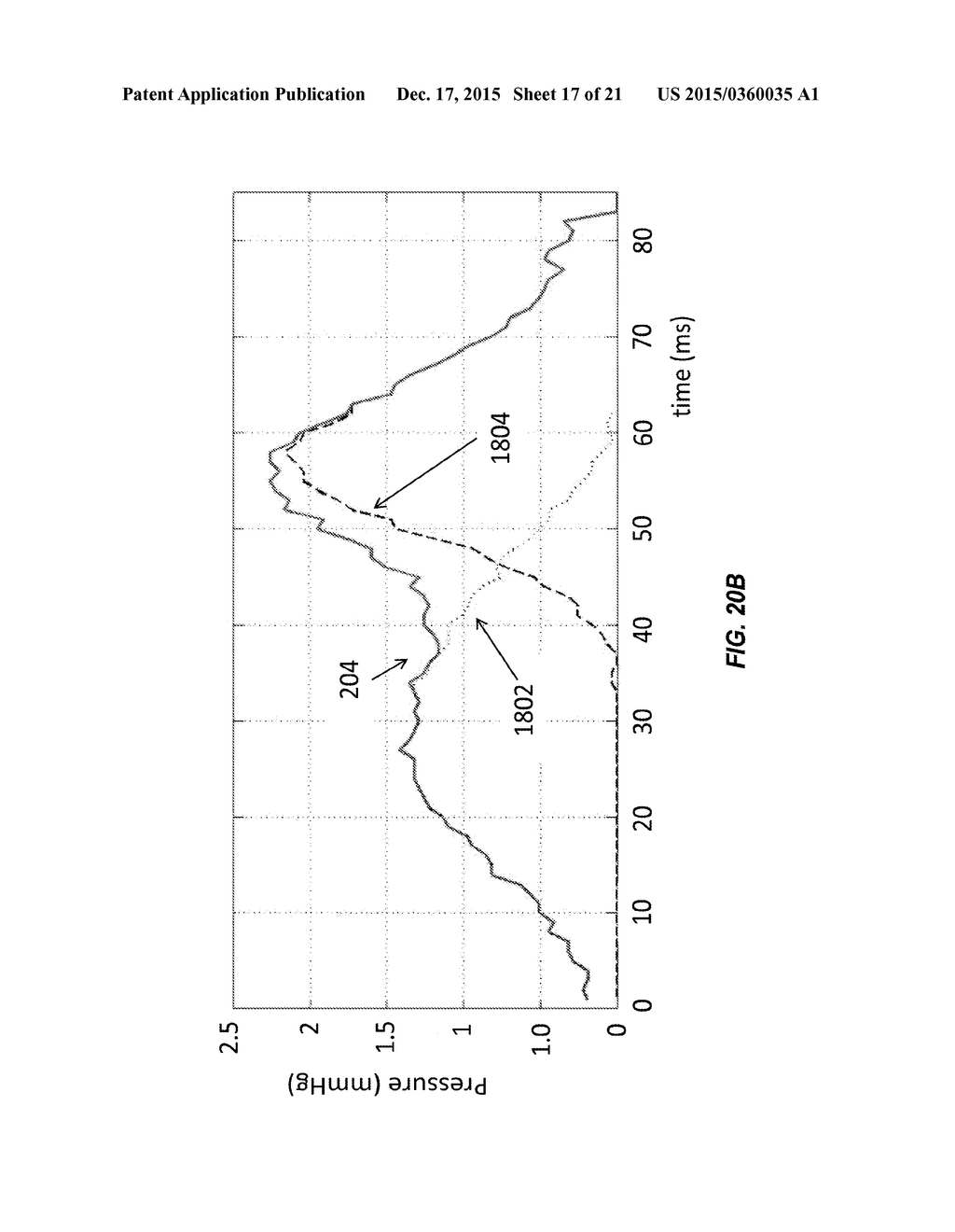 Methods And Systems For Controlling Blood Pressure By Controlling Atrial     Pressure - diagram, schematic, and image 18