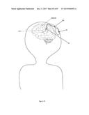 OPTOGENETIC THERAPIES FOR MOVEMENT DISORDERS diagram and image