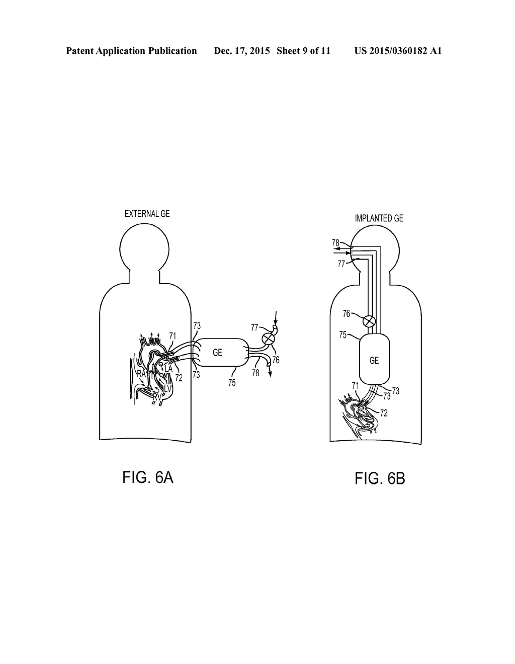 Gas Exchanger and Artificial Lung - diagram, schematic, and image 10