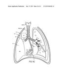 Gas Exchanger and Artificial Lung diagram and image